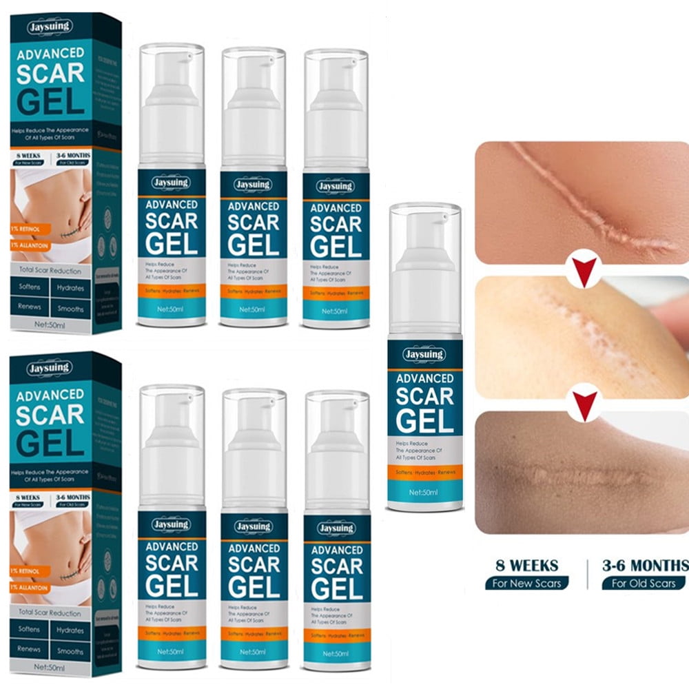 Scar Cream Gel, Tummy Tuck, Keloid, Acne Removal Treatment, Advanced