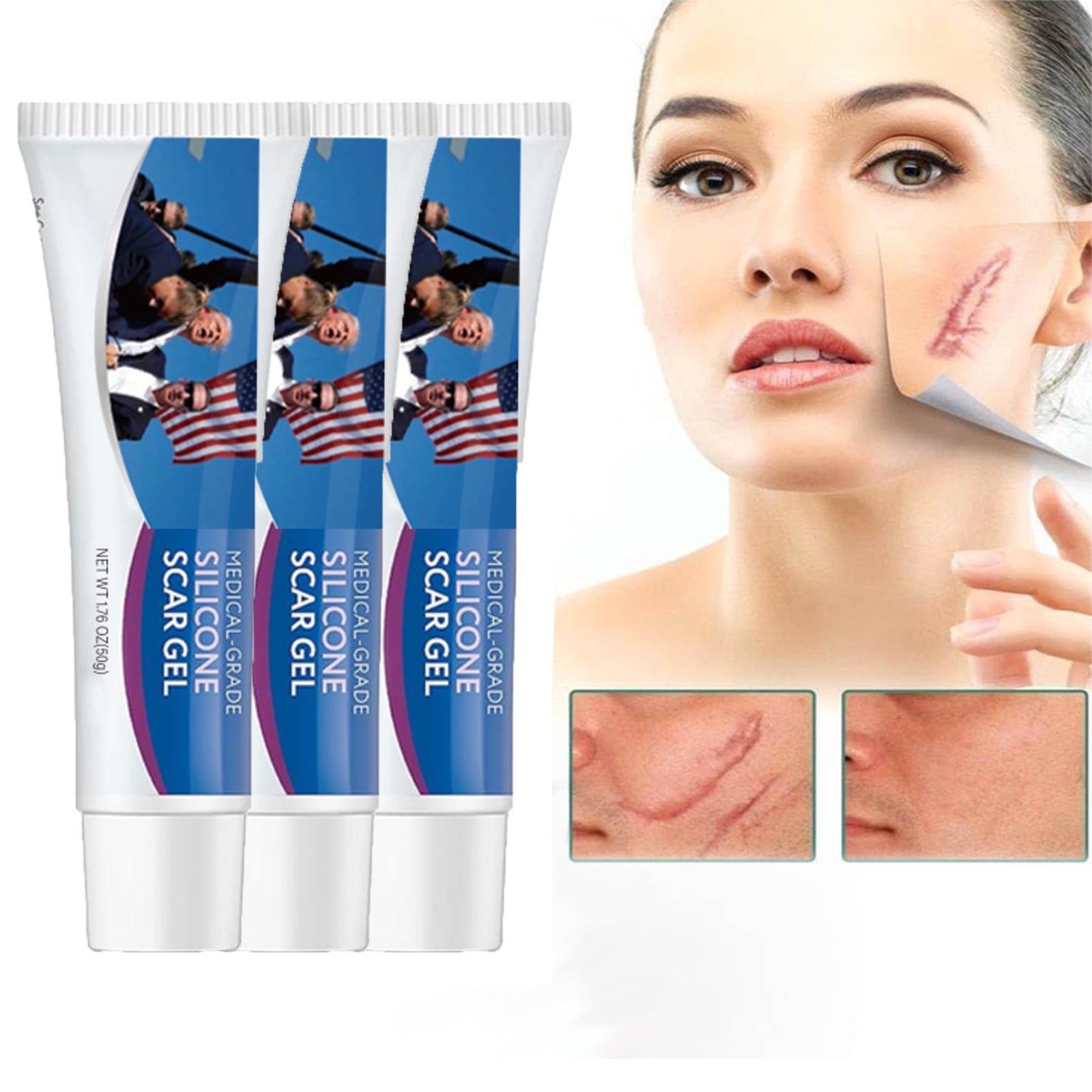 Scar Cream,Scar Away,Scar Gel,Advanced Scar Old and New Scars Reduces the Appearance of Scars
