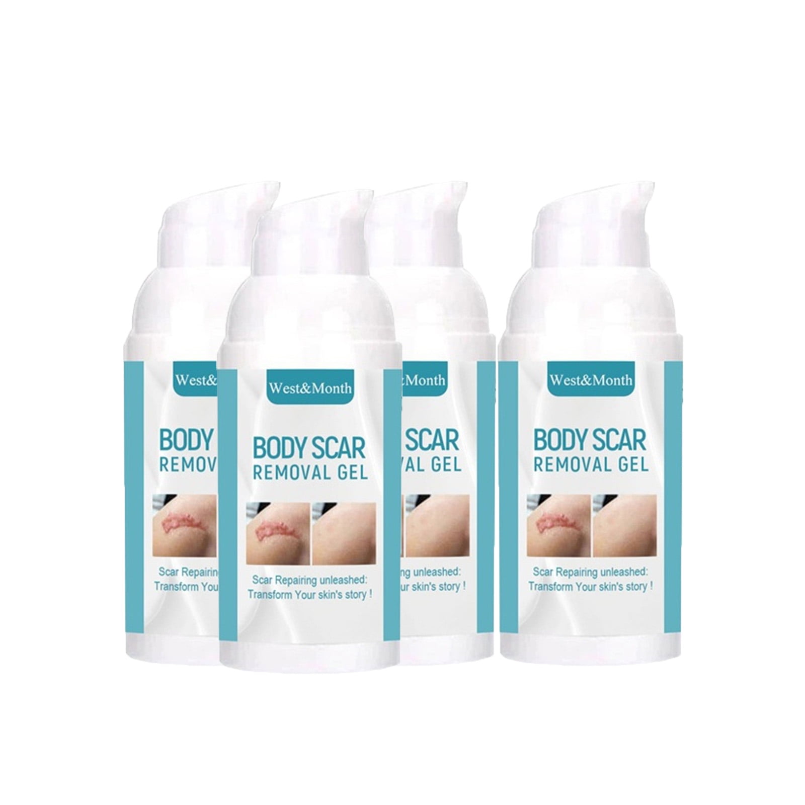 Scar Gel, Scar Cream, Advance Scar Gel for Face, Body, Leg, Burns, Acene, CSection, Stretch