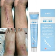 Scar Removal Cream Fast Removal Skin Scars Treat Surgery Scars Stretch Marks Acne Pox Prints Burn Moisturizing Repair Body Care