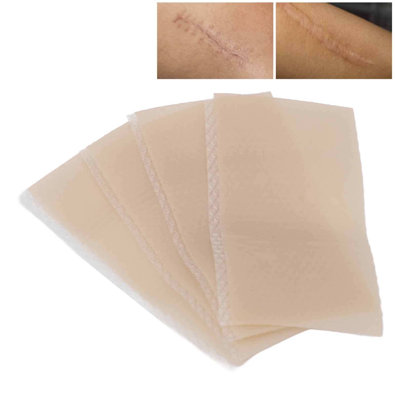 Scar Removal Treatment Tapes, Scar Sheets Soft Improve Skin Elasticity