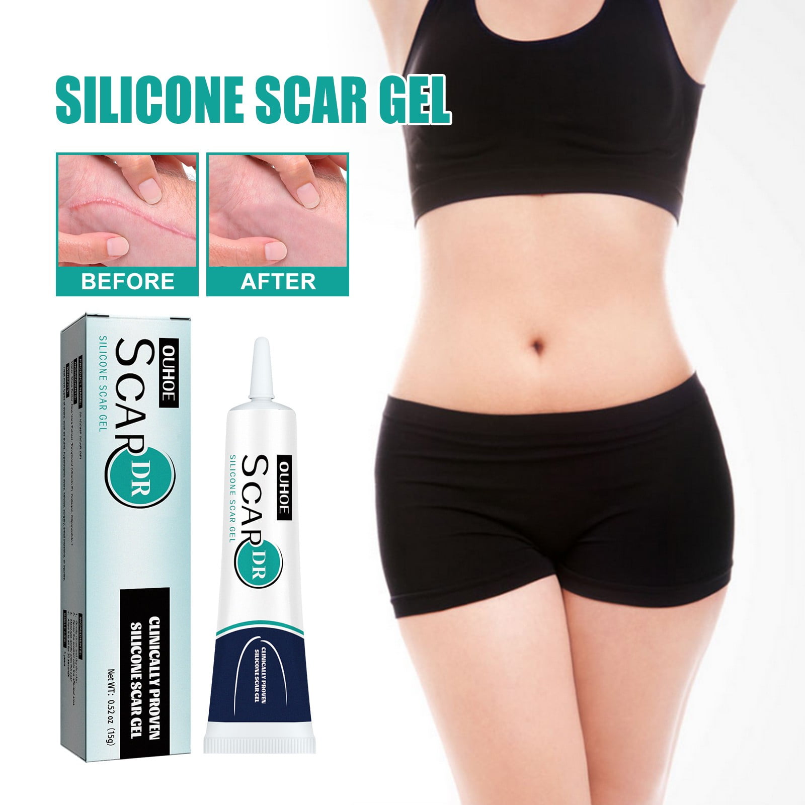 Scar Repair Gel, Surgical Scar Diluting Treatment, Deep Skin Repair and ...