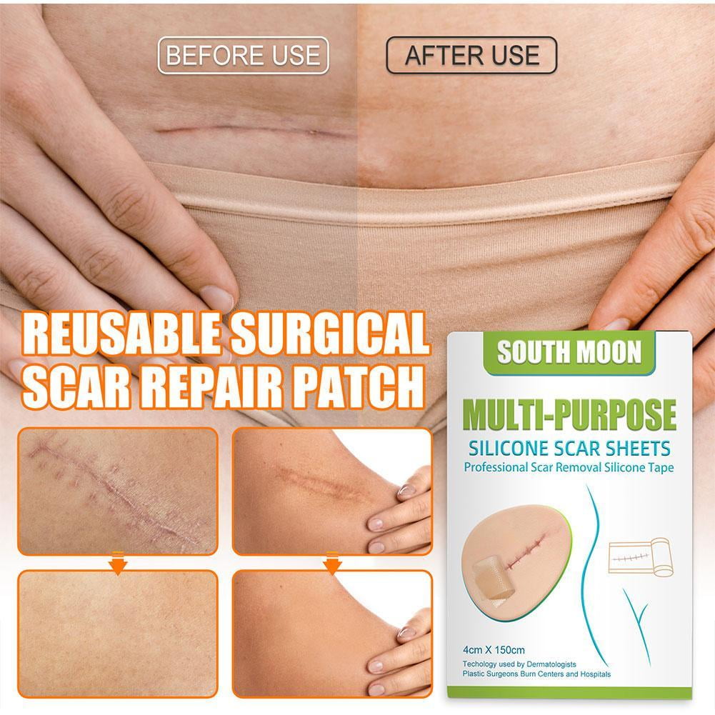 Scar Silicone Gel Sheet Patch Removal Skin Treatment Repair Wound Burn Efficient