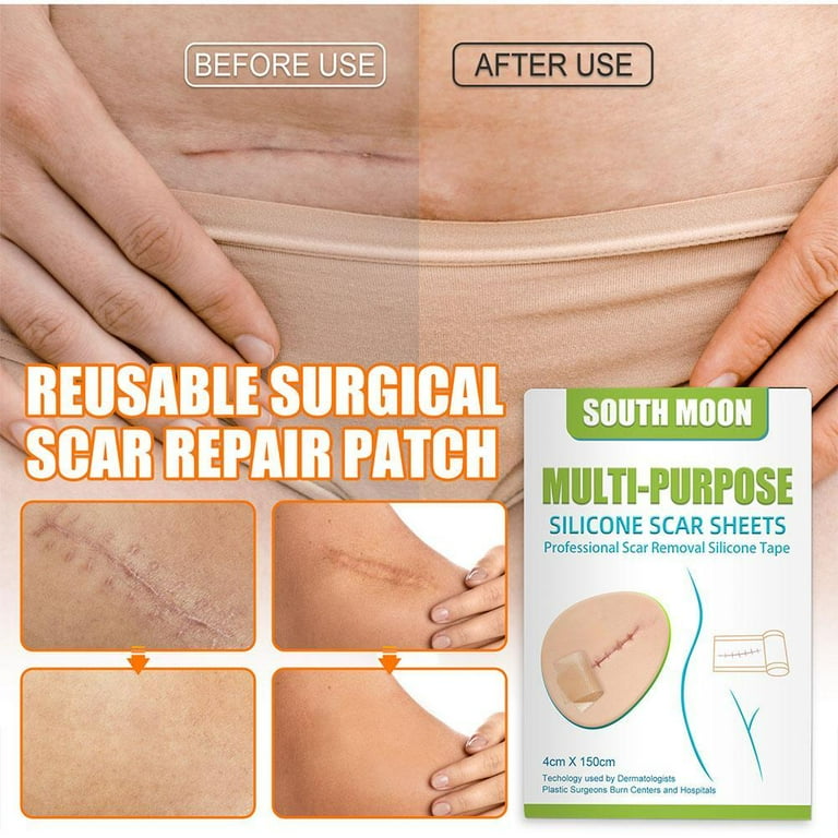 Scar best sale gel patch