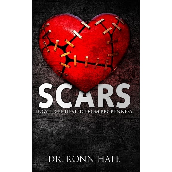 Scars: How to Be Healed from Brokenness (Paperback)