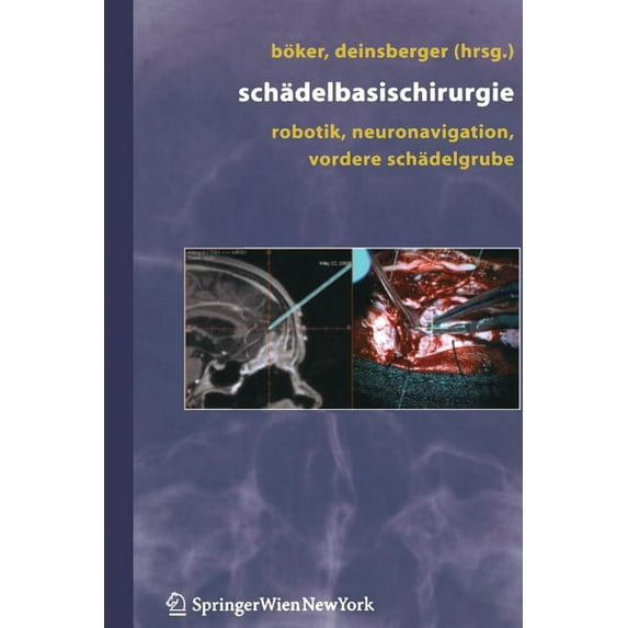 Schädelbasischirurgie: Robotik, Neuronavigation, Vordere Schädelgrube, (Paperback)
