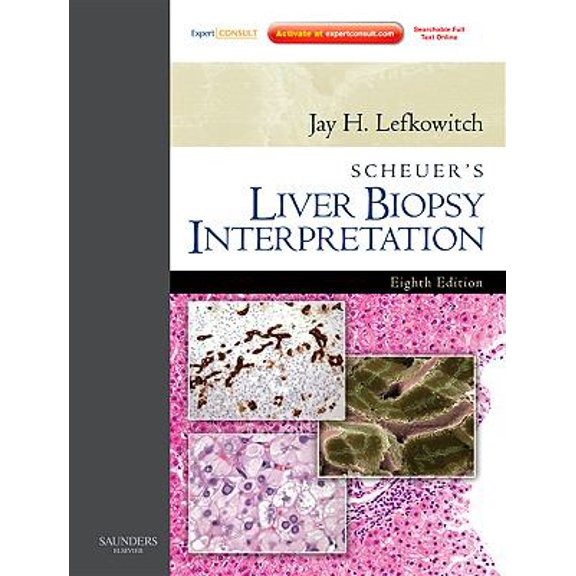 Pre-Owned Scheuer's Liver Biopsy Interpretation: Expert Consult: Online and Print (Hardcover) 070203410X 9780702034107