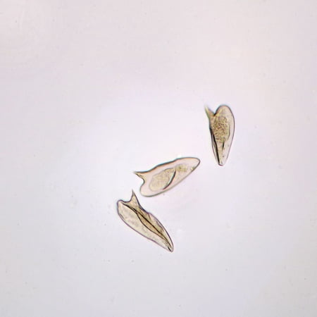 Schistosoma Mansoni Eggs Slide, W.M.