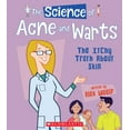 thumbnail image 1 of Science Of...: The Science of Acne and Warts: The Itchy Truth about Skin (the Science of the Body) (Paperback), 1 of 1