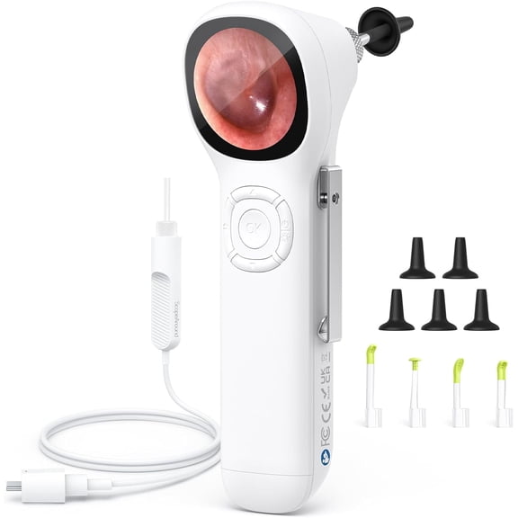 ScopeAround Otoscope 720P HD Ear Cleaning Camera with Light 1.45" IPS Display Digital Otoscope White