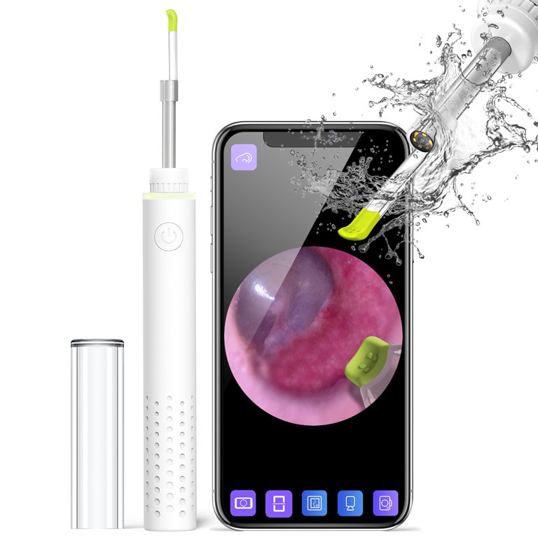 Scopearound Ear Wax Removal Tools, Otoscope Ear Cleaning Camera with 6  Adjustable LED Lights, Compatible with iPhone & Android and Tablet 