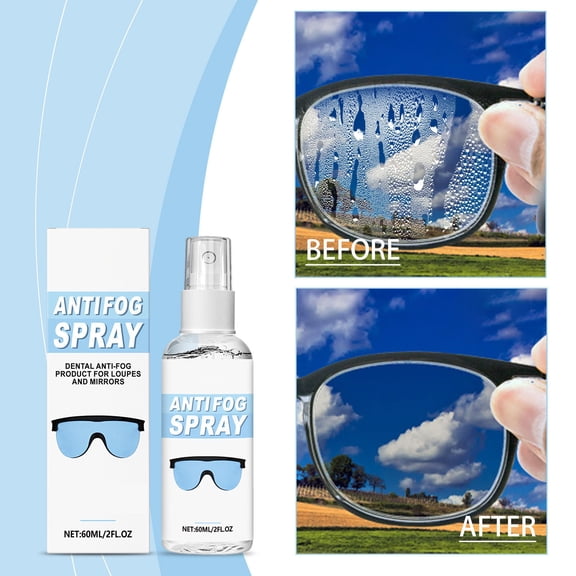 Scratch Remover Spray for Lenses Cleaning, Anti-Fog Protective Coating Solution, Optical Glass & Resin Lens Care, Eyeglasses Goggles Loupes Camera Lens Maintenance Cleaner Kit
