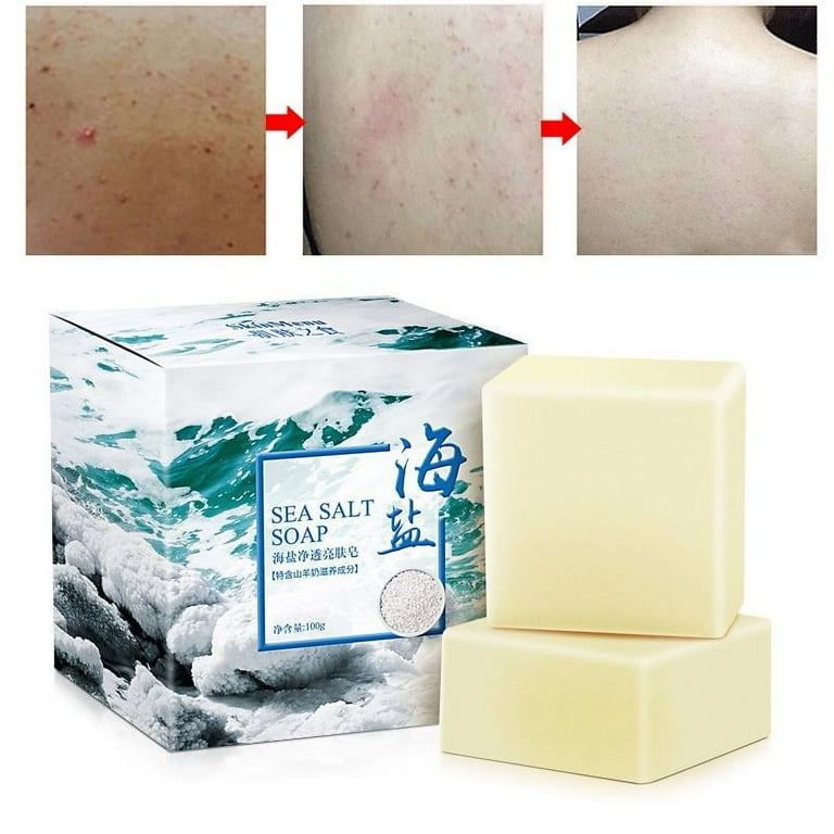 Acne clear soap outlet