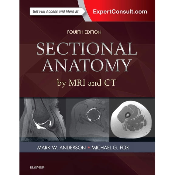 Pre-Owned Sectional Anatomy by MRI and CT [Hardcover] Anderson MD, Mark W. and Fox MD, Michael G