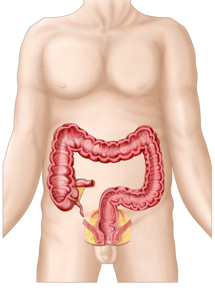 Sectional view of large intestine Canvas Art - Stocktrek Images (25 x 34)