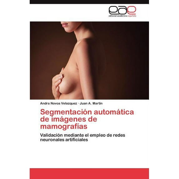 Segmentación automática de imágenes de mamografías (Paperback)