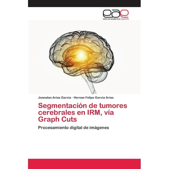 Segmentación de tumores cerebrales en IRM, vía Graph Cuts (Paperback)
