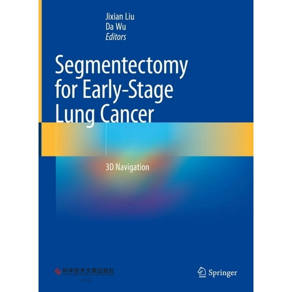 Segmentectomy for Early-Stage Lung Cancer: 3D Navigation, (Hardcover)