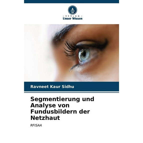 Segmentierung und Analyse von Fundusbildern der Netzhaut (Paperback)