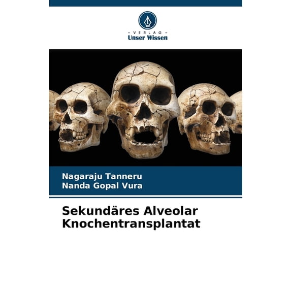 Sekundäres Alveolar Knochentransplantat, (Paperback)
