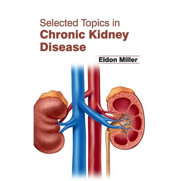 Selected Topics in Chronic Kidney Disease, (Hardcover)