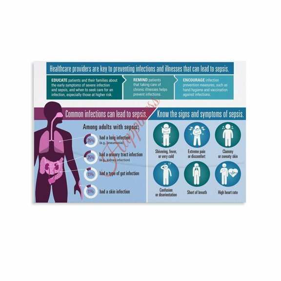 Sepsis Prevention Symptom Poster Sepsis Source Infection Warning Sign Chart Canvas for Living Room Bedroom Decor