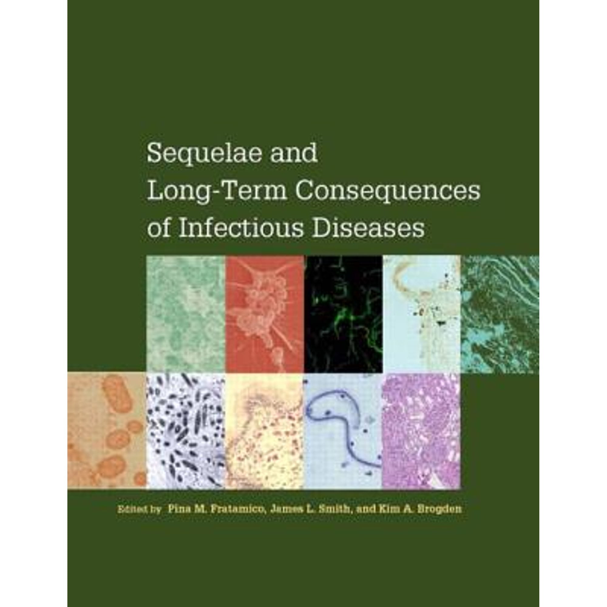 Pre-Owned Sequelae and Long-Term Consequences of Infectious Diseases ...