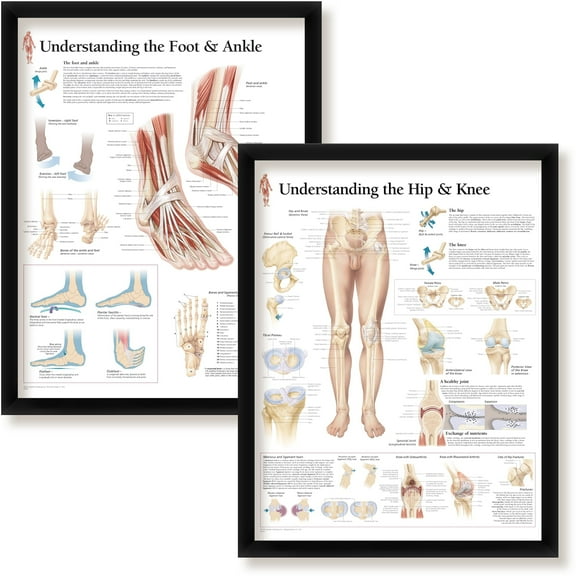 Set of 2 Framed Medical Posters Understanding The Hip and Knee and Understanding The Foot and Ankle 22"x28" Wall Diagrams Educational Informational Doctors Office Charts