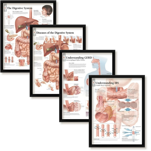 Set of 4 Framed Medical Posters The Digestive System, Diseases of The Digestive System, Understanding GERD, and Understanding IBS 22"x28" Wall Diagrams