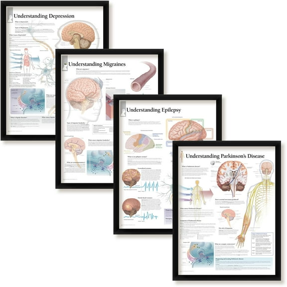 Set of 4 Framed Medical Posters Understanding Depression, Understanding Migraines, Understanding Epilepsy, and Understanding Parkinson"s Disease 22"x28" Wall Diagrams