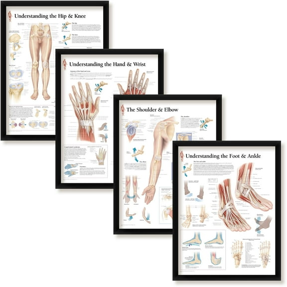 Set of 4 Framed Medical Posters Understanding The Hip and Knee; Foot and Ankle; Hand and Wrist; The Shoulder and Elbow 22"x28" Wall Diagrams Educational Informational Doctors Office Charts