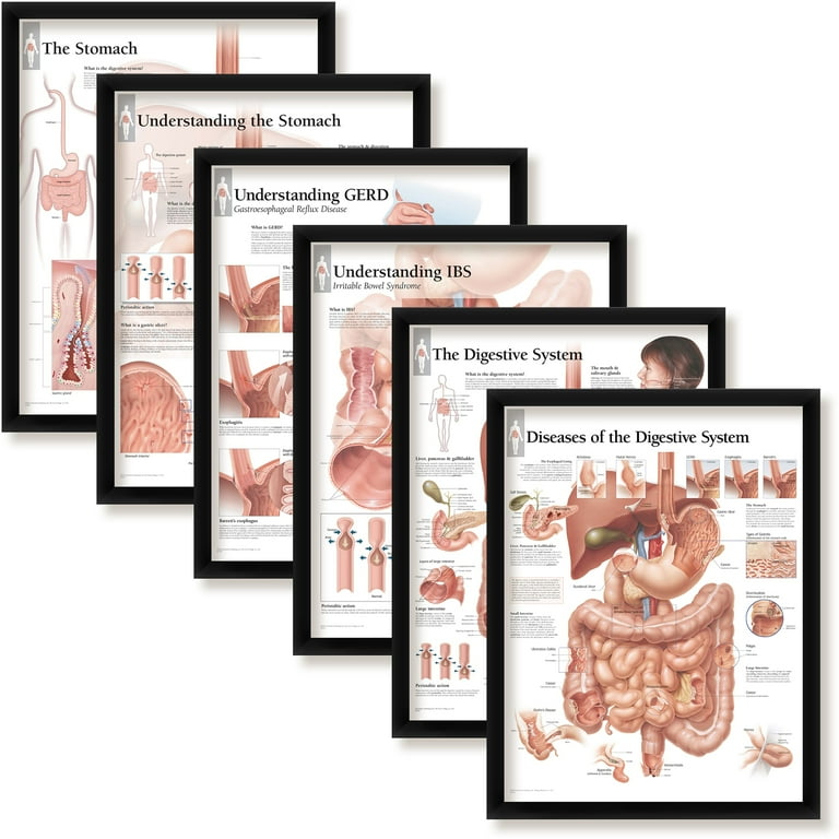 Set of 6 Framed Medical Posters The Stomach; Understanding The