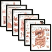 Set of 6 Framed Medical Posters The Stomach; Understanding The Stomach; Understanding GERD; Understanding IBS; The Digestive System 22x28 Wall Diagrams Educational Doctors Office Charts