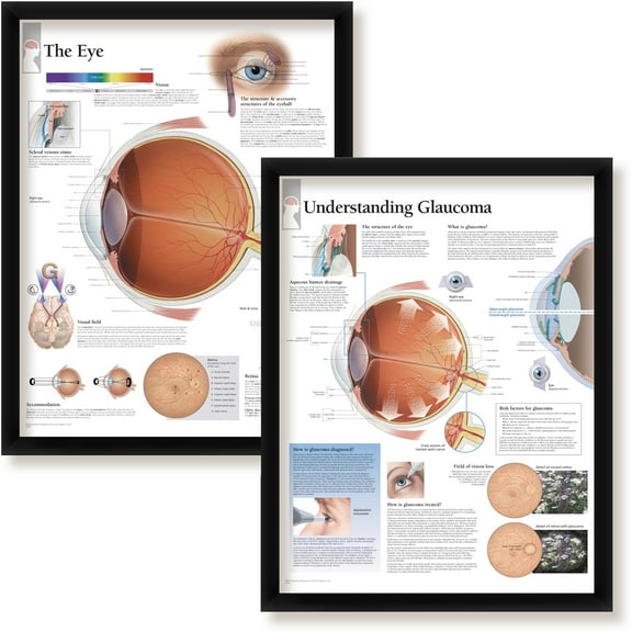 Set of 2 Framed Medical Posters The Eye and Understanding Glaucoma 22"x28" Wall Diagrams