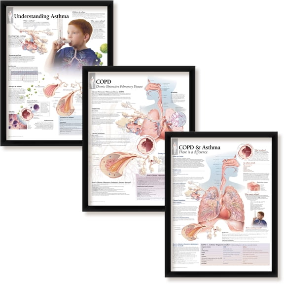 Set of 3 Framed Medical Posters Understanding Asthma, COPD, and COPD & Asthma 22"x28" Wall Diagrams