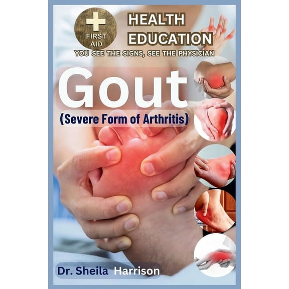 Sheila's Health Education Book Shelf: You See the Signs, See the Physician: Gout: Severe Form of Arthritis: Causes, Symptoms, Risk Modifiers Management, Treatment, MEDICATIONS(APPROVED BY ADA), Preven