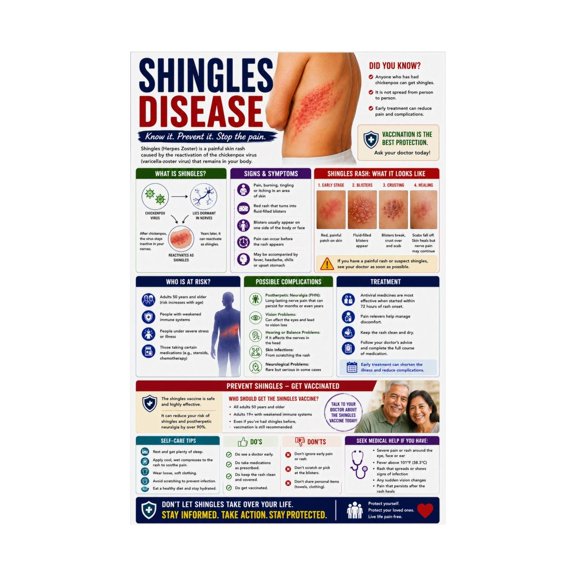 Shingles Disease Poster Medical Educational Wall Chart