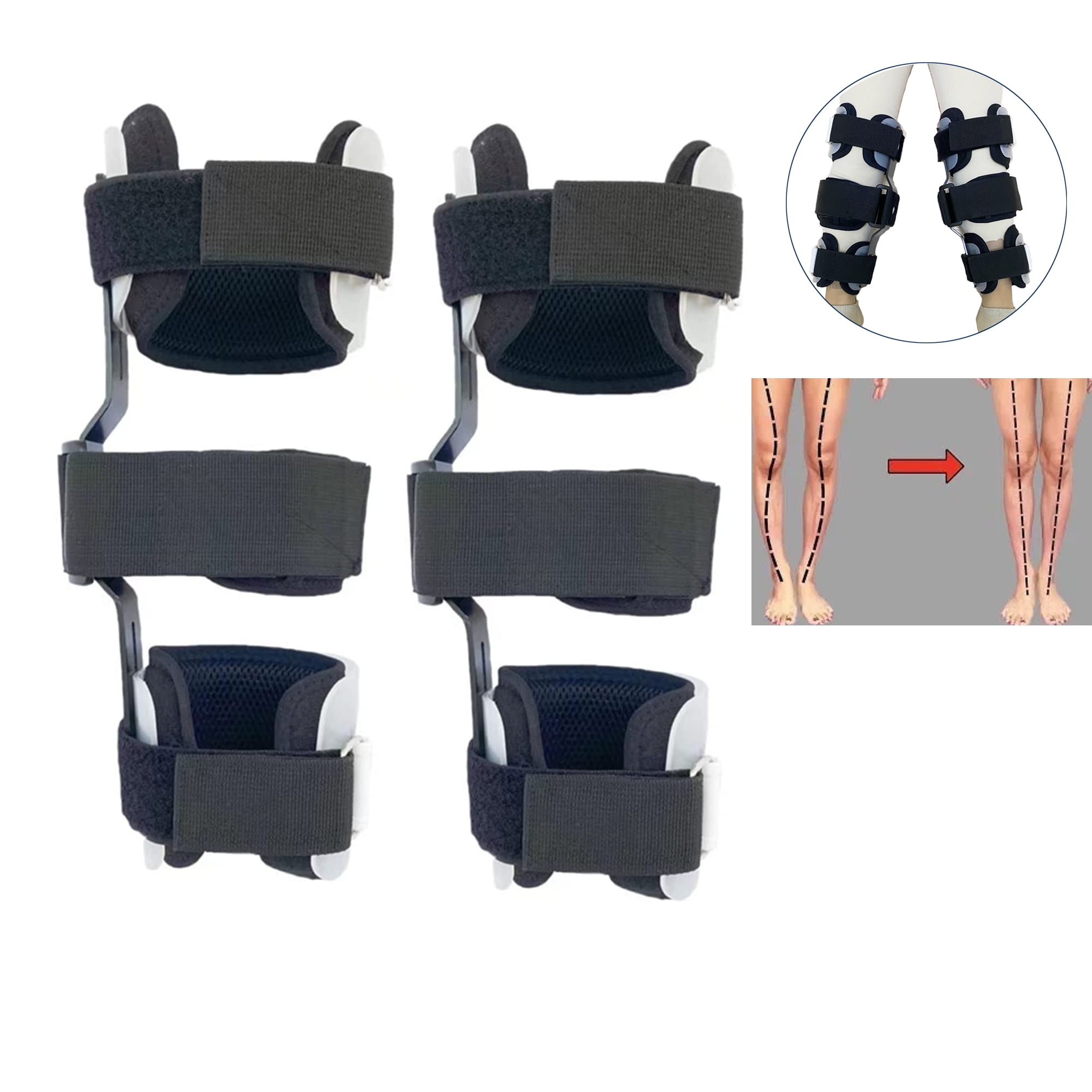 Shuyan Jiao Children Knock Knee Brace Children Bow Leg Correct Tool OX