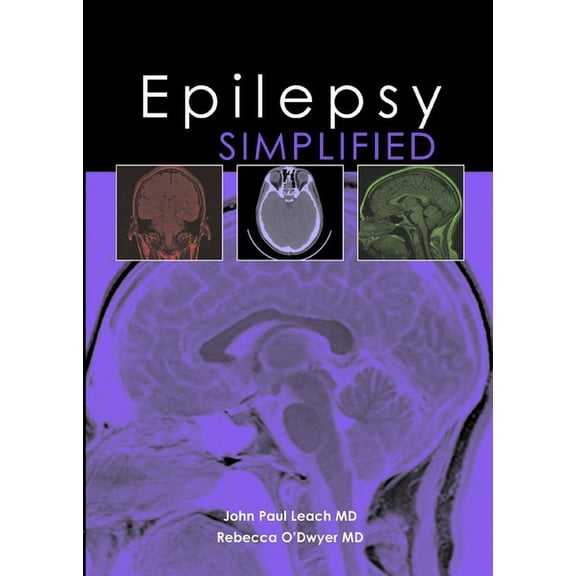 Simplified (TFM Publishing): Epilepsy Simplified (Paperback)