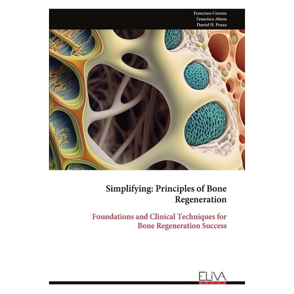 Simplifying: Principles of Bone Regeneration: Foundations and Clinical Techniques for Bone Regeneration Success, (Paperback)