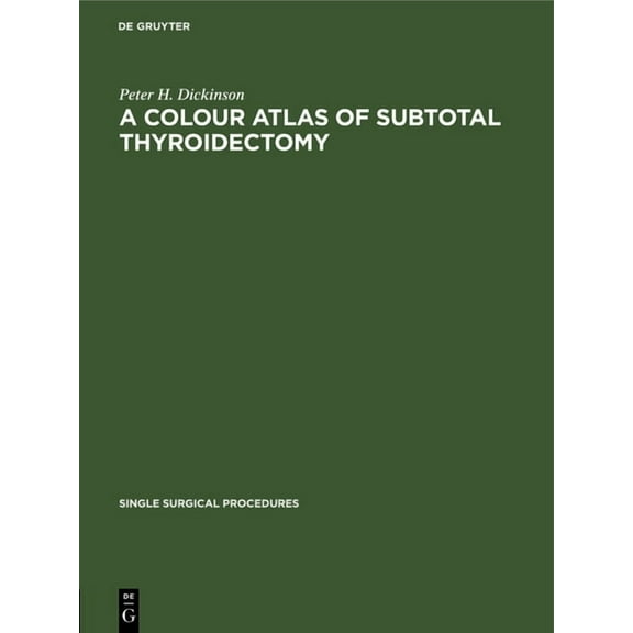 Single Surgical Procedures A Colour Atlas of Subtotal Thyroidectomy, Book 5, (Hardcover)