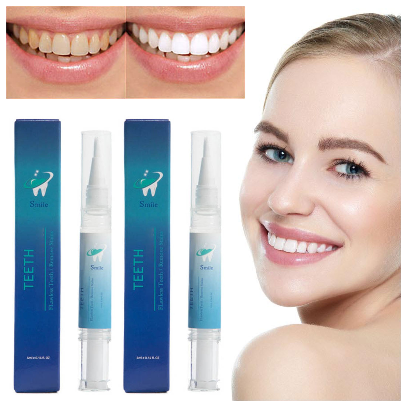 Siquannn 2pc Effective Tooth Cleaning Tools Spiral Instant Whiten Gel ...