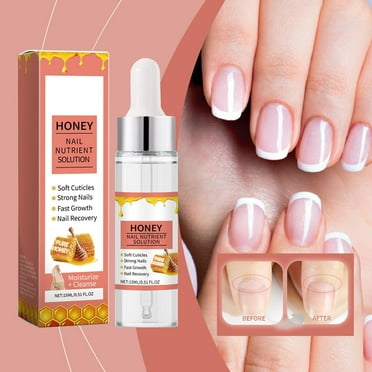 Siquannn Garlic Nail Polish Strengthener And Growth Cuticle Set Kerasal Foot Wash Toenail Cuticle Oil For Nails Tijeras Para Cuticula Profesional Funginix Nail Biting Polish For Kids Sheer Nail Polish