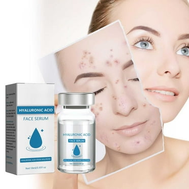 Siquannn Lip Filler Face Moisturizer for Oily Skin Korean Aloe Infusion Korean Choice Moisturizer Travel Size Korean Face Mist for Dry Skin Texture Tomato Glass Skin Gel Face Firming Amazing