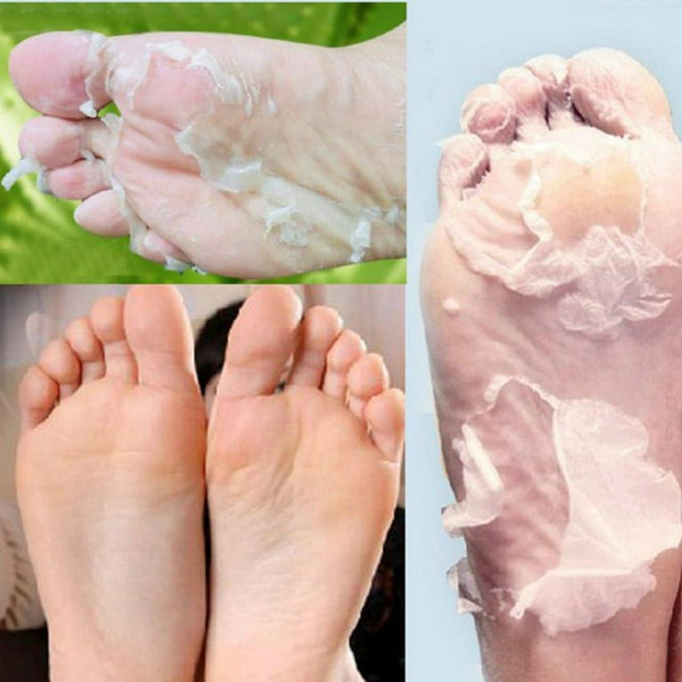 Siquannnn 1Pair Exfoliating Peel Foot Mask Baby Soft Feet Remove Callus Hard Dead Skin Pedicure Socks Walmart
