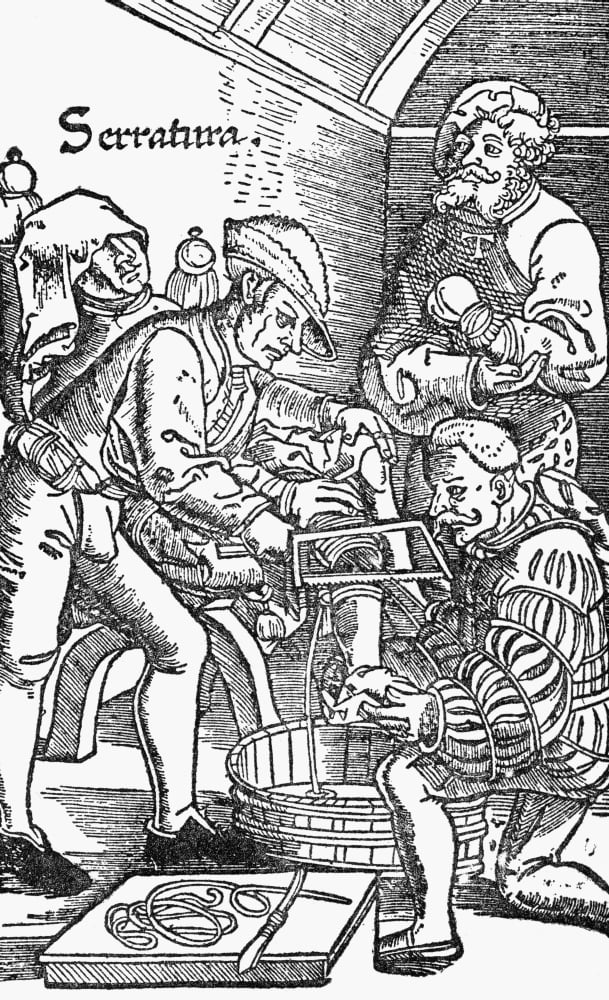 Sixteenth Century Amputation Canvas Art - Ken Welsh Design Pics (22 x 36)