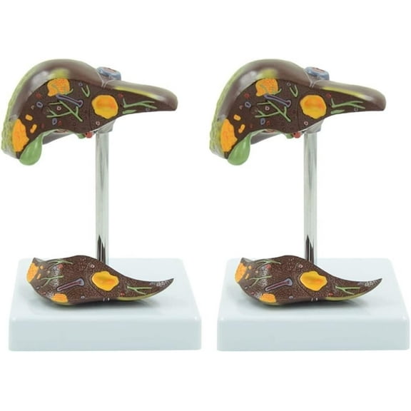 Skeleton Models, Human Models, Life-Size Liver Anatomical Models, Pancreas Models for Medical Research and Teaching(1 Pack)