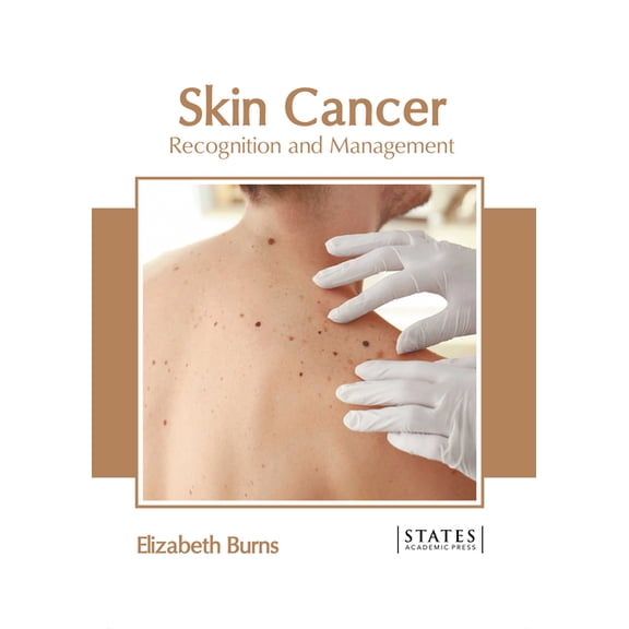 Skin Cancer: Recognition and Management, (Hardcover)