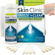 Skin Clinic FREEZE 'n CLEAR™ Advanced Wart Remover, Tough on Warts, Gentle on Skin, (12 Precision Applicators)