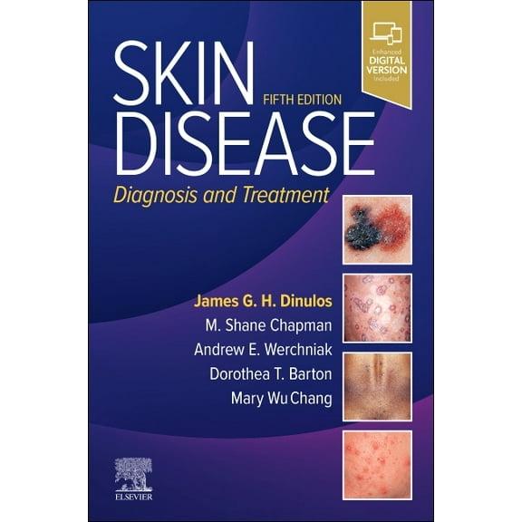 Skin Disease: Diagnosis and Treatment, (Paperback)